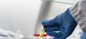 Covid-19 : les tests rapides antigènes vont doper les capacités de dépistage en Afrique (OMS)
