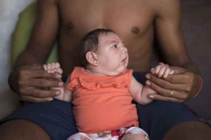 Zika : ce virus qui transforme les bébés. Quels en sont les symptômes et les risques ?