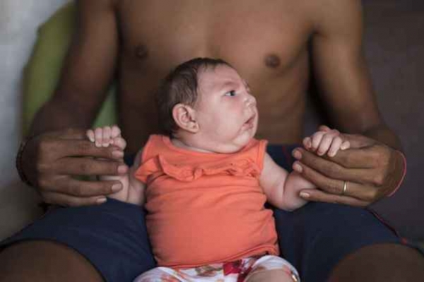 Zika : ce virus qui transforme les bébés. Quels en sont les symptômes et les risques ?